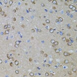 Immunohistochemistry - Anti-PRAMEF20 Antibody (A90492) - Antibodies.com