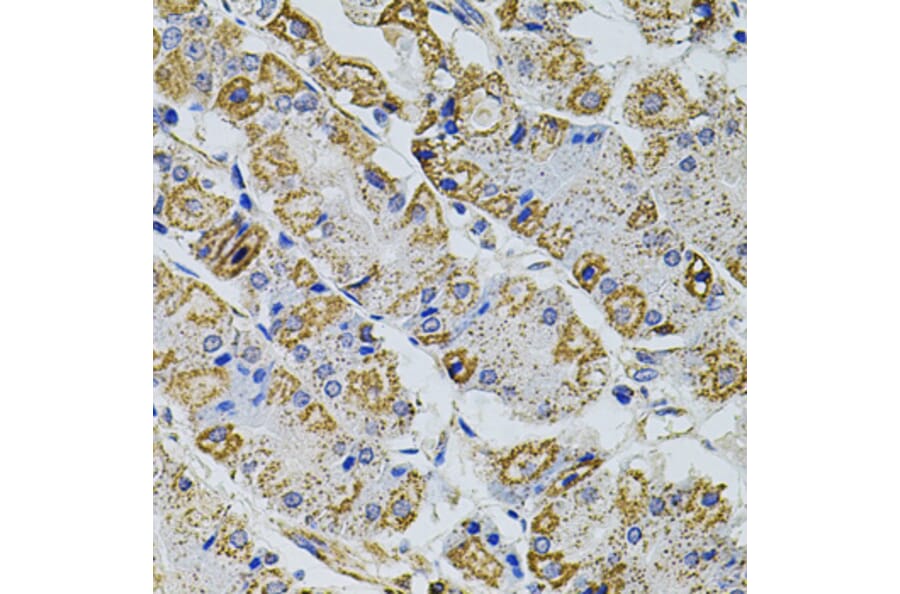 Immunohistochemistry - Anti-PRAMEF20 Antibody (A90492) - Antibodies.com