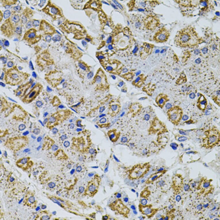 Immunohistochemistry - Anti-PRAMEF20 Antibody (A90492) - Antibodies.com
