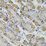 Immunohistochemistry - Anti-PRAMEF20 Antibody (A90492) - Antibodies.com