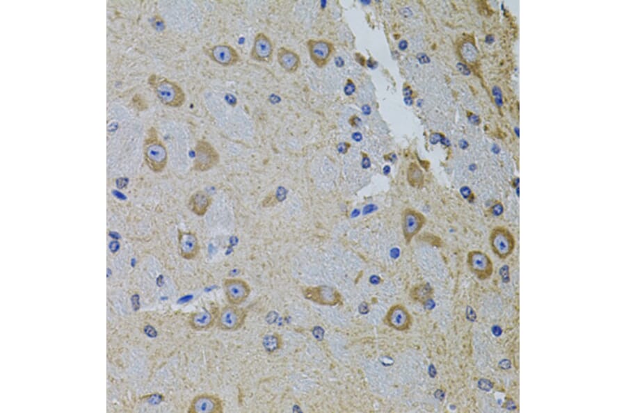 Immunohistochemistry - Anti-PRAMEF20 Antibody (A90492) - Antibodies.com