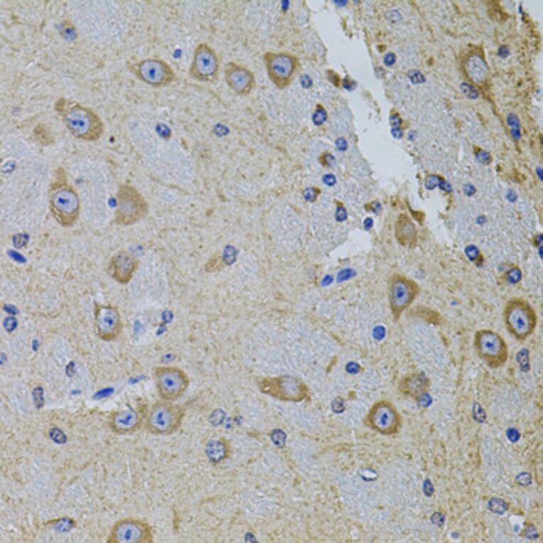Immunohistochemistry - Anti-PRAMEF20 Antibody (A90492) - Antibodies.com