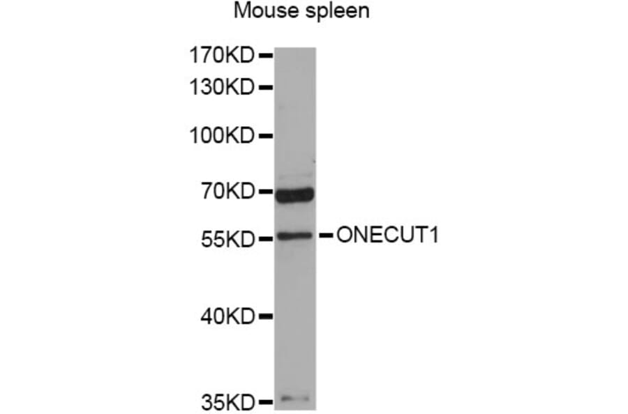 Western Blot - Anti-ONECUT1 Antibody (A9668) - Antibodies.com