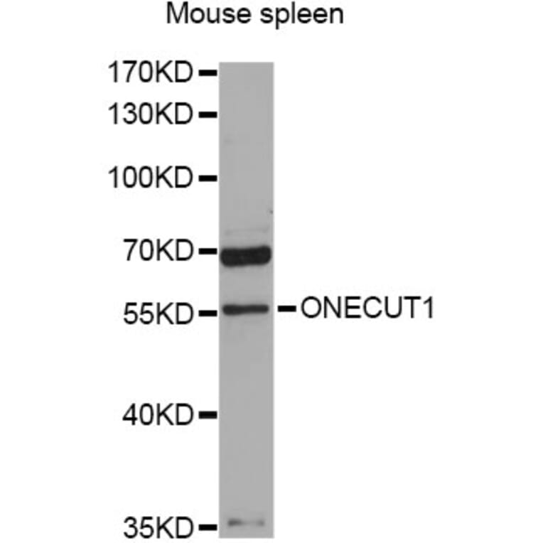 Western Blot - Anti-ONECUT1 Antibody (A9668) - Antibodies.com