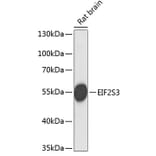 Western Blot - Anti-EIF2G/EIF2S3 Antibody (A90495) - Antibodies.com