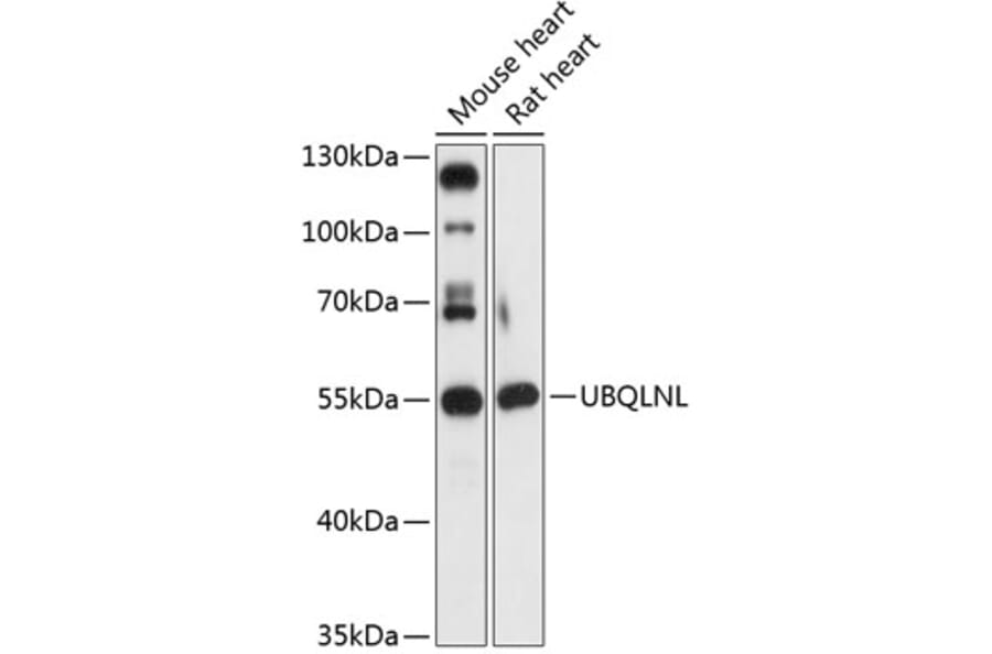 Western Blot - Anti-UBQLNL Antibody (A90496) - Antibodies.com