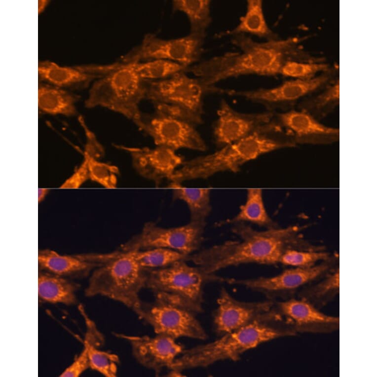 Immunofluorescence - Anti-UBQLNL Antibody (A90496) - Antibodies.com
