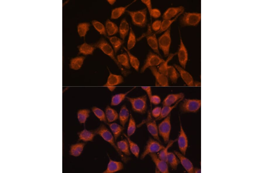 Immunofluorescence - Anti-UBQLNL Antibody (A90496) - Antibodies.com