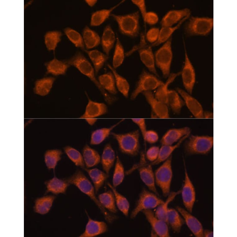 Immunofluorescence - Anti-UBQLNL Antibody (A90496) - Antibodies.com