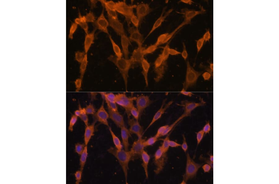 Immunofluorescence - Anti-UBQLNL Antibody (A90496) - Antibodies.com
