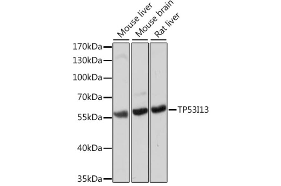 Western Blot - Anti-TP53I13 Antibody (A90497) - Antibodies.com