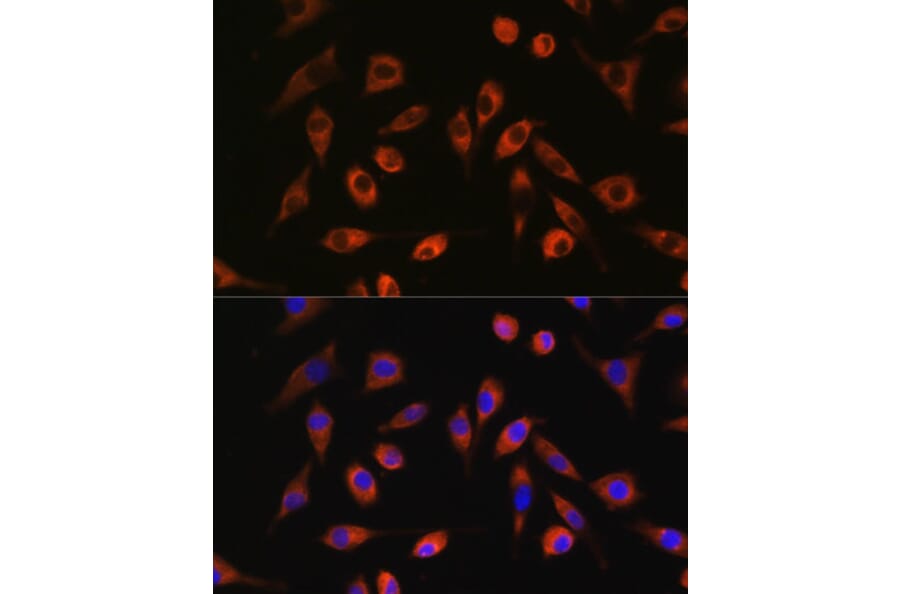Immunofluorescence - Anti-TP53I13 Antibody (A90497) - Antibodies.com