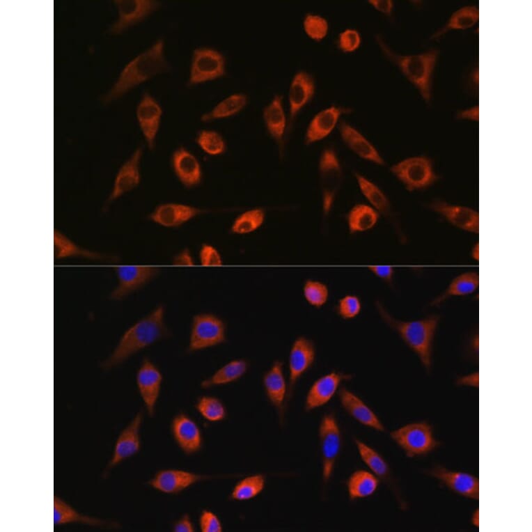 Immunofluorescence - Anti-TP53I13 Antibody (A90497) - Antibodies.com
