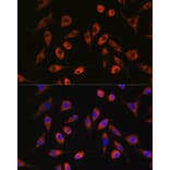 Immunofluorescence - Anti-TP53I13 Antibody (A90497) - Antibodies.com