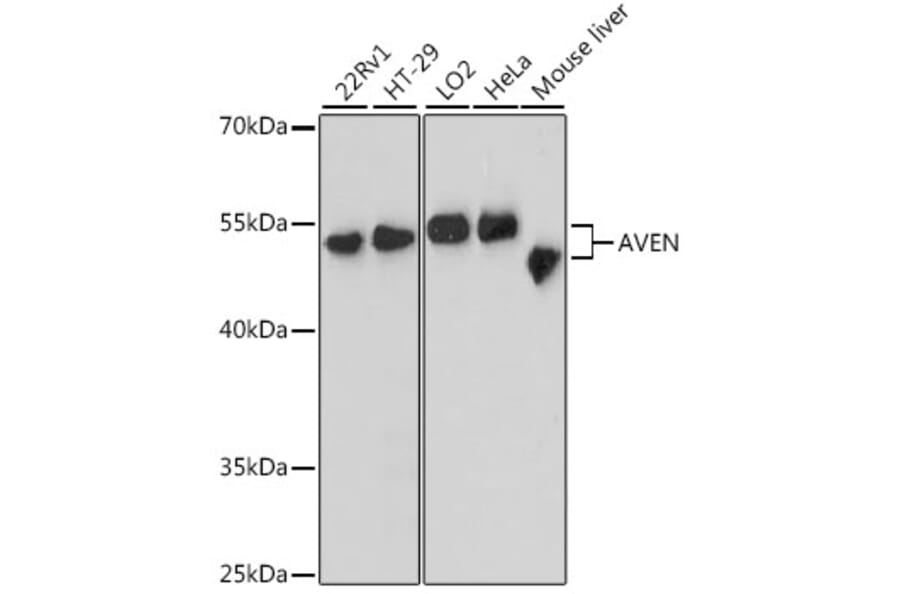 Western Blot - Anti-AVEN Antibody (A90498) - Antibodies.com