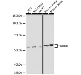 Western Blot - Anti-KRT81 Antibody (A90499) - Antibodies.com