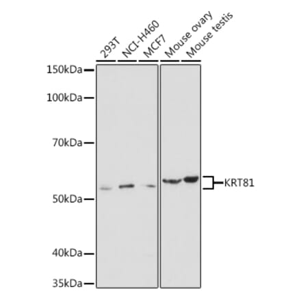 Western Blot - Anti-KRT81 Antibody (A90499) - Antibodies.com