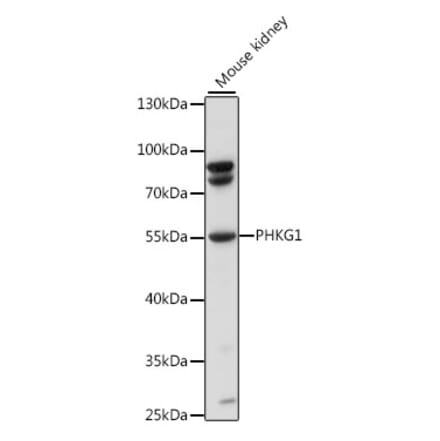 Western Blot - Anti-PHKG1 Antibody (A90500) - Antibodies.com