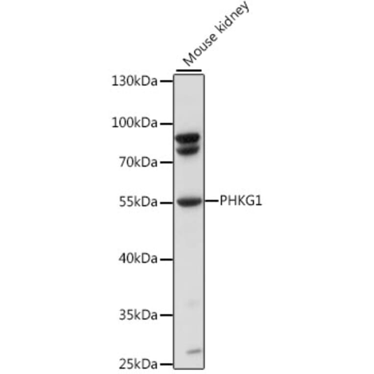 Western Blot - Anti-PHKG1 Antibody (A90500) - Antibodies.com