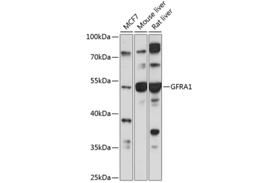 Western Blot - Anti-GDNF Receptor alpha 1 / GFRA1 Antibody (A90502) - Antibodies.com