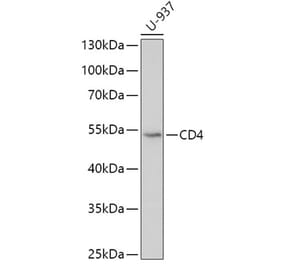Western Blot - Anti-CD4 Antibody (A90503) - Antibodies.com
