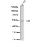Western Blot - Anti-CD4 Antibody (A90503) - Antibodies.com