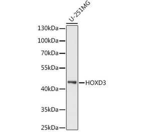 Western Blot - Anti-HOXD3 Antibody (A90504) - Antibodies.com