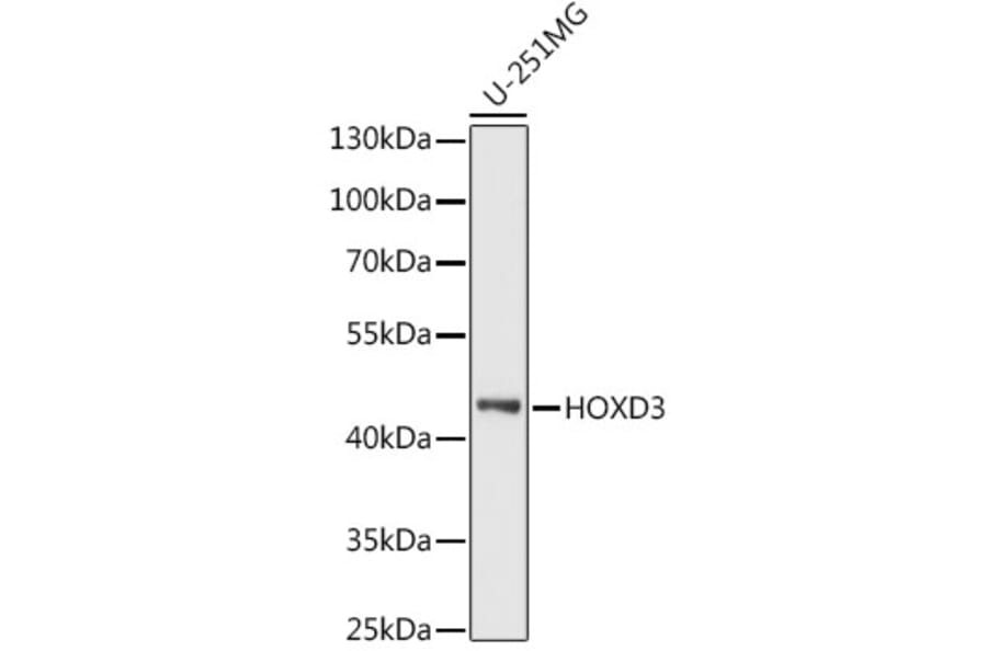 Western Blot - Anti-HOXD3 Antibody (A90504) - Antibodies.com