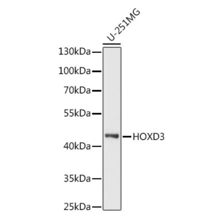 Western Blot - Anti-HOXD3 Antibody (A90504) - Antibodies.com