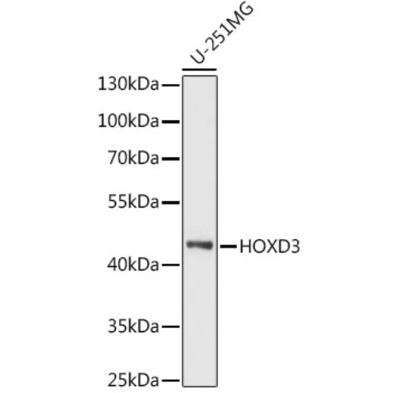 Western Blot - Anti-HOXD3 Antibody (A90504) - Antibodies.com