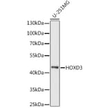 Western Blot - Anti-HOXD3 Antibody (A90504) - Antibodies.com