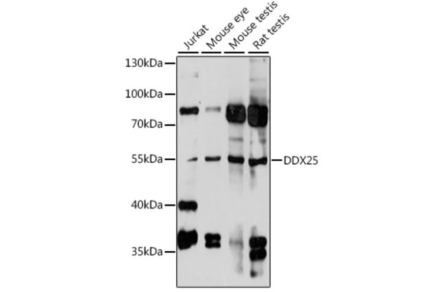 Western Blot - Anti-DDX25 Antibody (A90505) - Antibodies.com