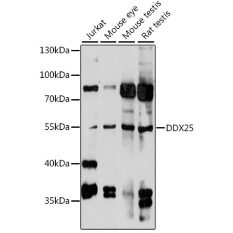 Western Blot - Anti-DDX25 Antibody (A90505) - Antibodies.com