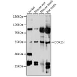 Western Blot - Anti-DDX25 Antibody (A90505) - Antibodies.com