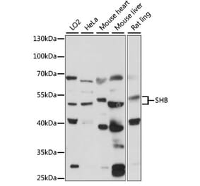 Western Blot - Anti-SHB Antibody (A90506) - Antibodies.com