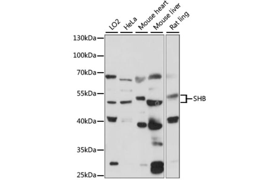Western Blot - Anti-SHB Antibody (A90506) - Antibodies.com
