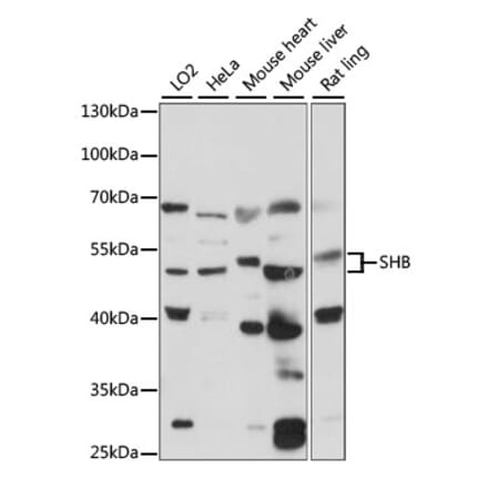 Western Blot - Anti-SHB Antibody (A90506) - Antibodies.com