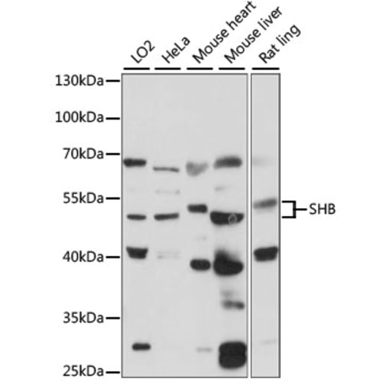 Western Blot - Anti-SHB Antibody (A90506) - Antibodies.com