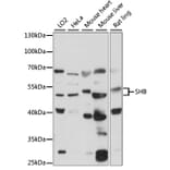 Western Blot - Anti-SHB Antibody (A90506) - Antibodies.com