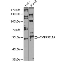 Western Blot - Anti-TMPRSS11A Antibody (A90507) - Antibodies.com