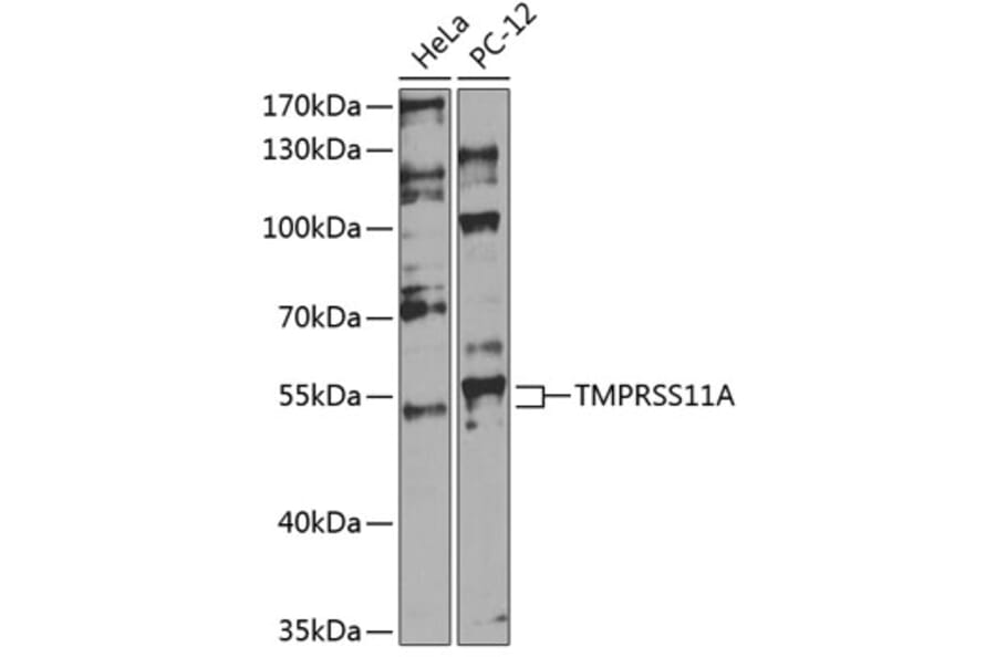 Western Blot - Anti-TMPRSS11A Antibody (A90507) - Antibodies.com