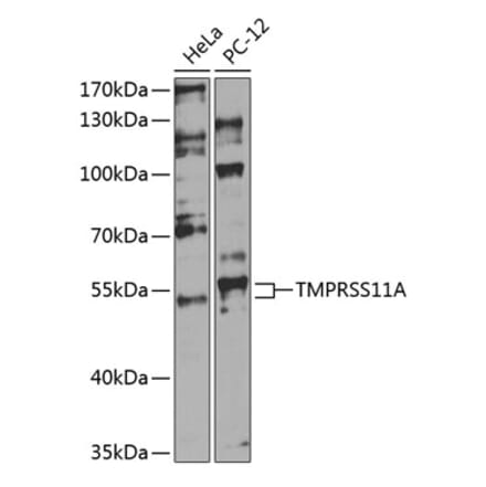 Western Blot - Anti-TMPRSS11A Antibody (A90507) - Antibodies.com