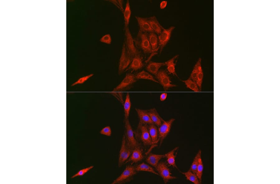 Immunofluorescence - Anti-NFkB p105/p50 Antibody (A90508) - Antibodies.com