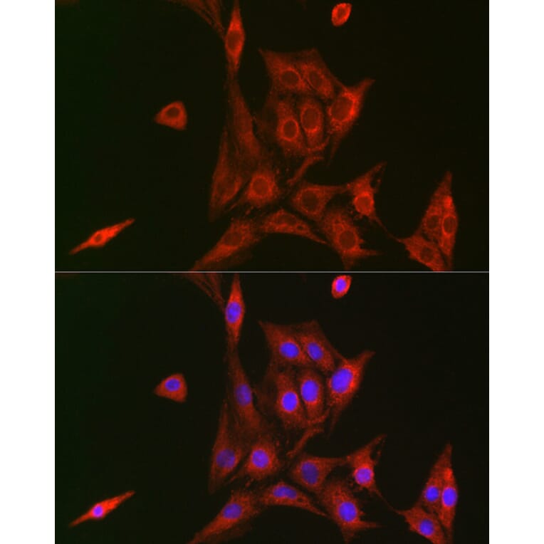 Immunofluorescence - Anti-NFkB p105 / p50 Antibody (A90508) - Antibodies.com