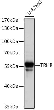 Western blot analysis of extracts of U-87MG cells, using Anti-TRHR Antibody (A15235) at 1:1,000 dilution.
Secondary antibody: Goat Anti-Rabbit IgG (H+L) (HRP) (AS014) at 1:10,000 dilution.
Lysates / proteins: 25µg per lane.
Blocking buffer: 3% non-fat dry milk in TBST.
Detection: ECL Basic Kit (RM00020).
Exposure time: 20s.