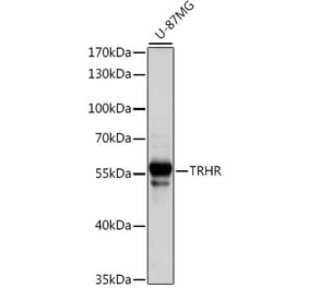 Western Blot - Anti-TRH-R Antibody (A90509) - Antibodies.com