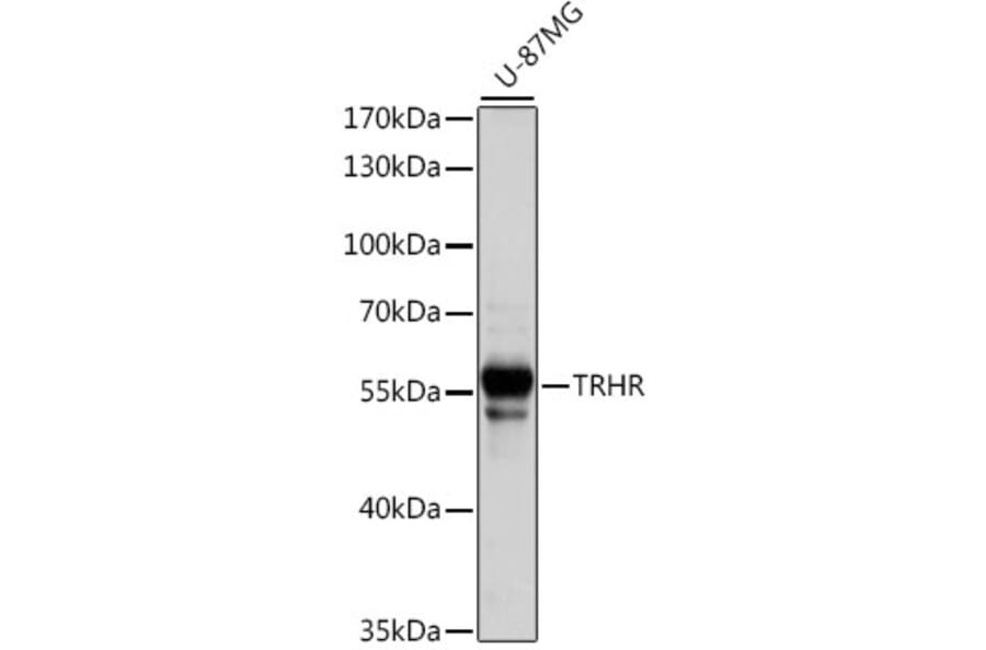 Western Blot - Anti-TRH-R Antibody (A90509) - Antibodies.com
