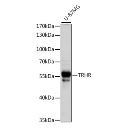 Western Blot - Anti-TRH-R Antibody (A90509) - Antibodies.com
