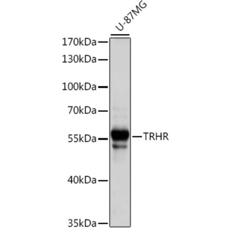 Western Blot - Anti-TRH-R Antibody (A90509) - Antibodies.com