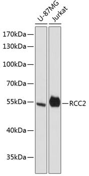 Western blot analysis of extracts of various cell lines, using Anti-RCC2 Antibody (A13105) at 1:3000 dilution.
Secondary antibody: Goat Anti-Rabbit IgG (H+L) (HRP) (AS014) at 1:10,000 dilution.
Lysates / proteins: 25µg per lane.
Blocking buffer: 3% non-fat dry milk in TBST.
Detection: ECL Basic Kit (RM00020).
Exposure time: 90s.